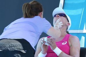 Samantha Stosur's match got off to a slow start, with the top seed getting a blood nose during the warm-up. Picture: Getty Images